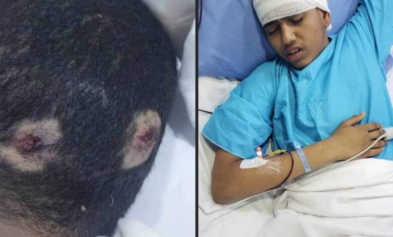 عناصر حوثية تطلق النار على طفل في الحديدة 1 عناصر حوثية تطلق النار على طفل في الحديدة