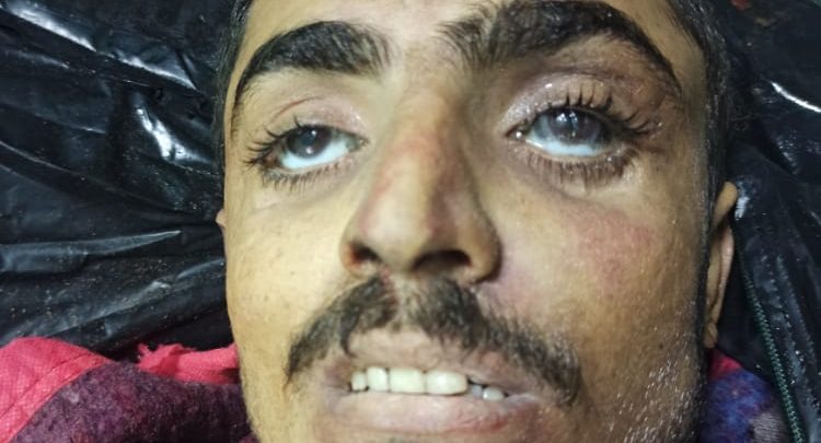 بنيران المشتركة .. مصرع القيادي الحوثي عبدالوهاب محمد علي بدر الدين بالدريهمي 1 بنيران المشتركة .. مصرع القيادي الحوثي عبدالوهاب محمد علي بدر الدين بالدريهمي