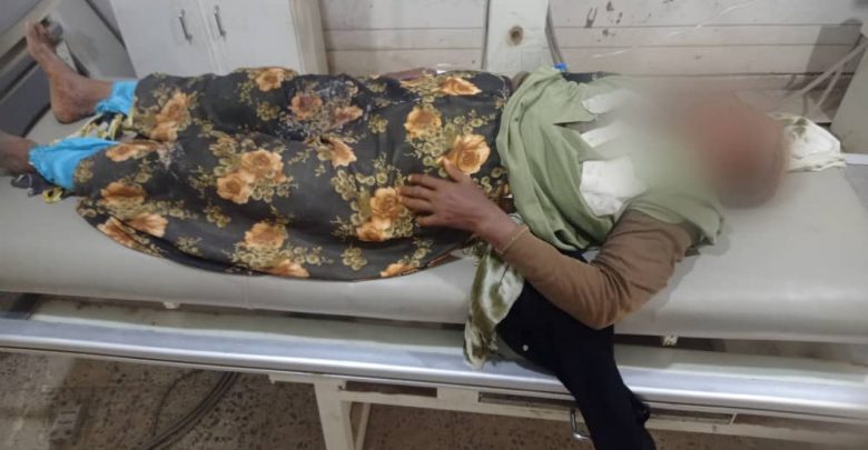 الحديدة .. إصابة مواطنة خمسينية برصاصة حوثية في حيس 1 الحديدة .. إصابة مواطنة خمسينية برصاصة حوثية في حيس