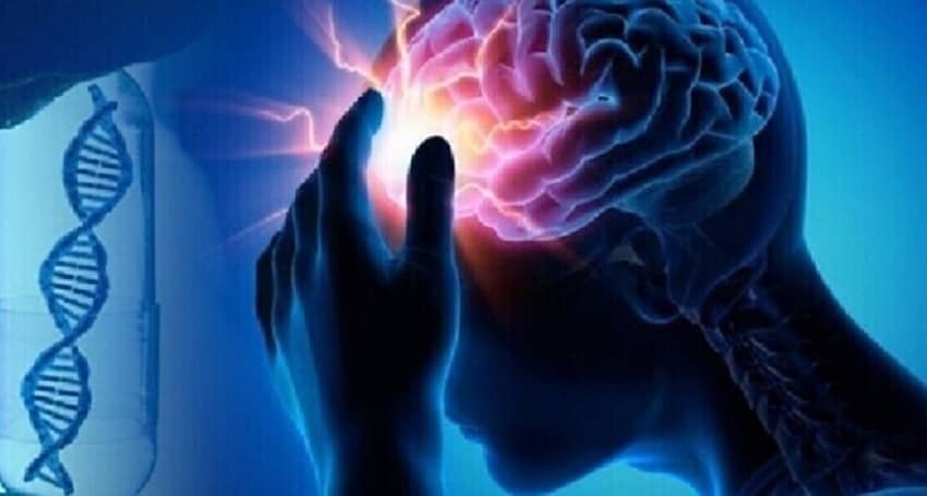 7 علامات للجلطة الدماغية الصامتة .. تعرف عليها 1 7 علامات للجلطة الدماغية الصامتة .. تعرف عليها