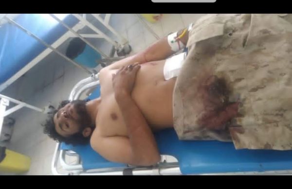 أول الحوثيين المحاصرين في جبهة علفاء بنجد المجمعة بمأرب يسلم نفسه 1 أول الحوثيين المحاصرين في جبهة علفاء بنجد المجمعة بمأرب يسلم نفسه