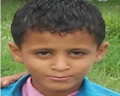 لغم حوثي على شكل لعبة يقتل طفلا في إب 1 لغم حوثي على شكل لعبة يقتل طفلا في إب