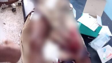 إصابة مواطن بجروح بليغة بانفجار مقذوف حوثي في حيس