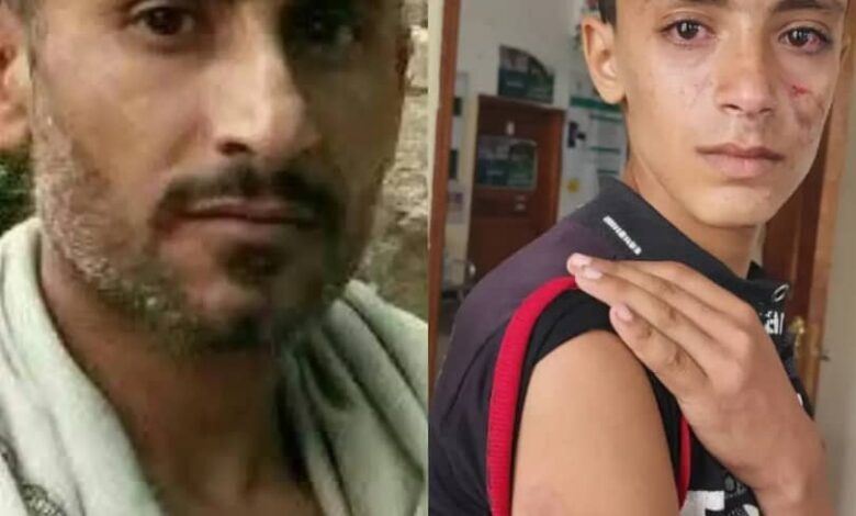 مشرف حوثي يعتدي بوحشية على طفل ووالدته في ريمة