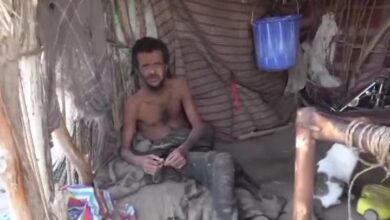 الخلية الإنسانية بالمقاومة الوطنية تستجيب لحالة إنسانية لمعاق في قرية قنزة
