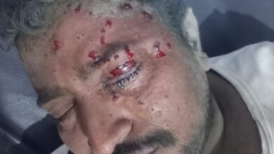 الحديدة.. إصابة مزارع بجروح بالغة جراء انفجار لغم من مخلفات الحوثي في حيس 8 الحديدة.. إصابة مزارع بجروح بالغة جراء انفجار لغم من مخلفات الحوثي في حيس