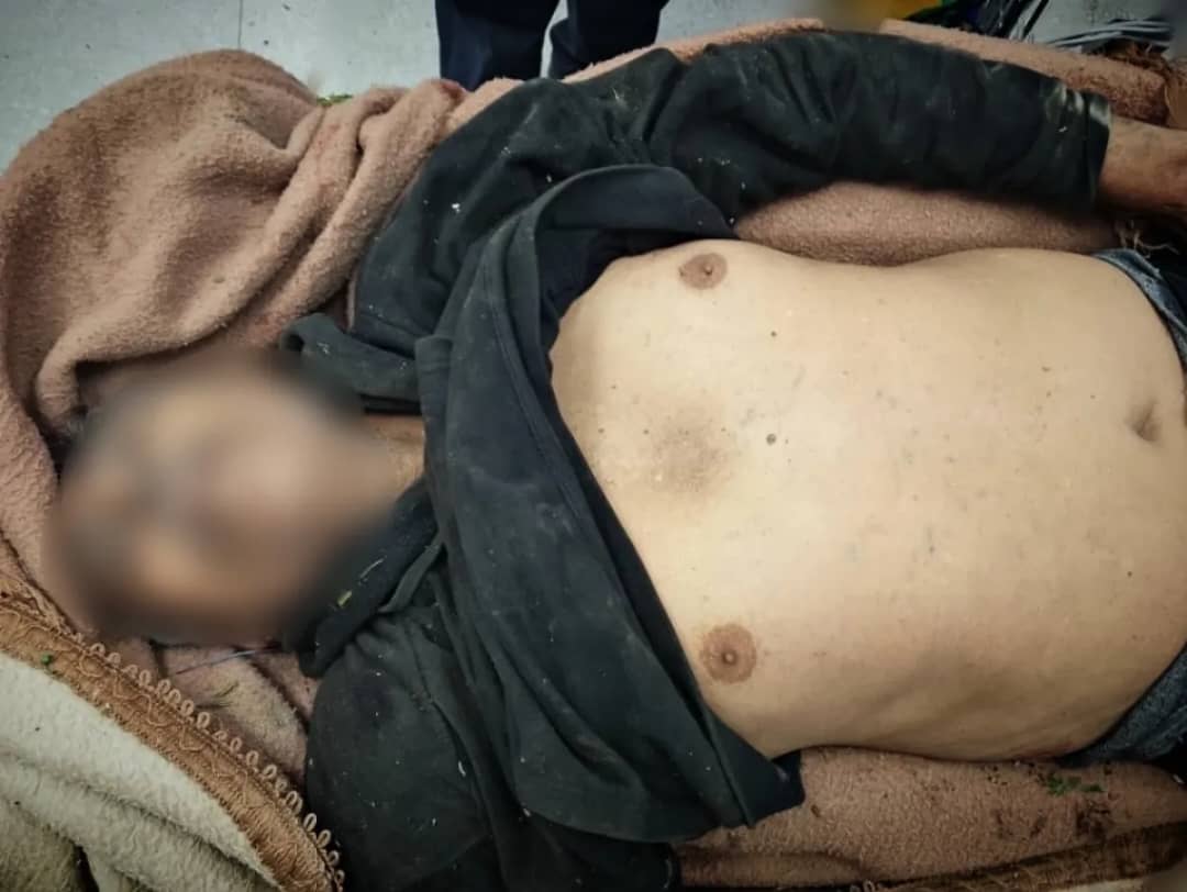 قناصة الحوثي تغتال مسناً في تعز وتواصل استهداف المدنيين