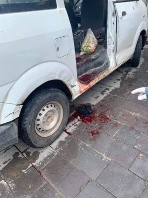 رصاص مليشيا الحوثي يقتل رجل وزوجته في مدينة إب
