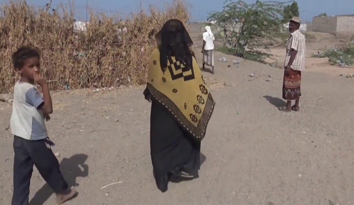 الحديدة.. جرح مدني برصاص قناص حوثي في حيس 1 الحديدة.. جرح مدني برصاص قناص حوثي في حيس