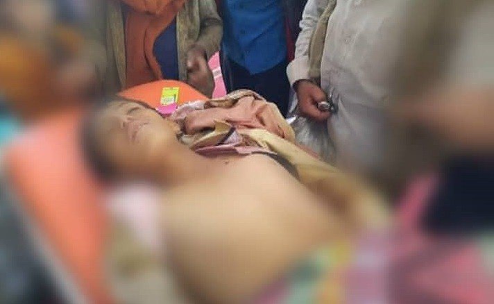 مقتل طفل برصاص قناصة الحوثي بالضالع 1 مقتل طفل برصاص قناصة حوثي بالضالع