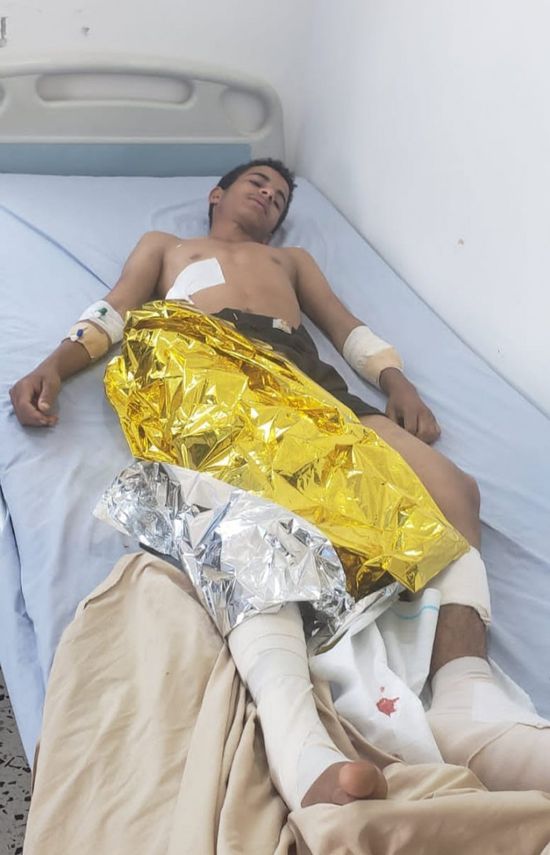إصابة ثلاثة أطفال أشقاء بمقذوف حوثي في الضالع