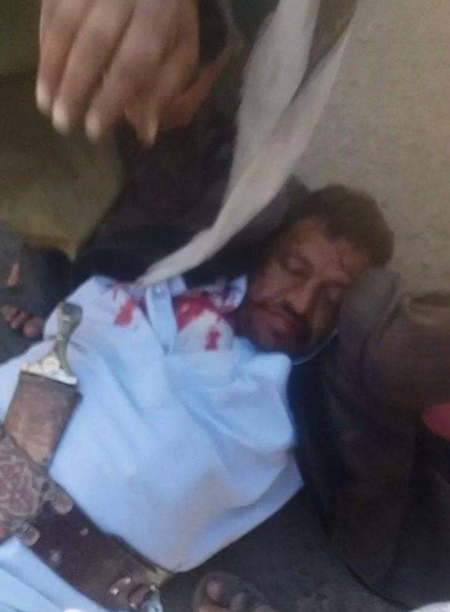 مشرف حوثي يقتل مواطن في ذمار .. لهذا السبب 1 مشرف حوثي يقتل مواطن في ذمار .. لهذا السبب