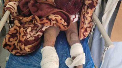 إصابة مزارع وبتر ساقه بانفجار لغم حوثي شرق صنعاء