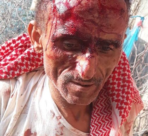 شبكة حقوقية تدين اعتداء الحوثيين على طبيب أمام أسرته في إب 1 شبكة حقوقية تدين اعتداء الحوثيين على طبيب أمام أسرته في إب