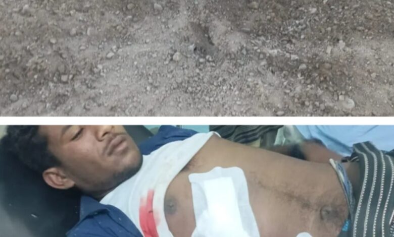 بقذائف الهاون.. مليشيا الحوثي تستهدف مخيماً للنازحين جنوبي الحديدة وتصيب مدنياً بجروح بليغة 1 بقذائف الهاون.. مليشيا الحوثي تستهدف مخيماً للنازحين جنوبي الحديدة وتصيب مدنياً بجروح بليغة