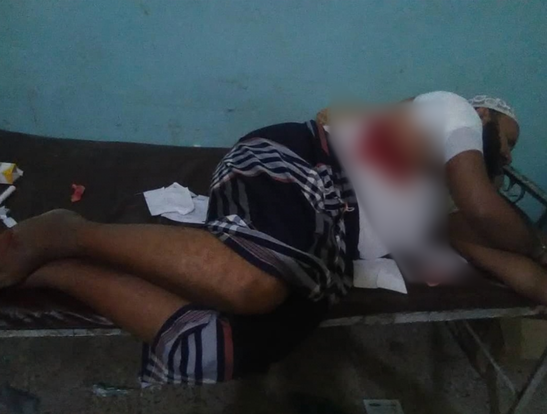 جرح مدني برصاص قناصة حوثي بمدينة حيس