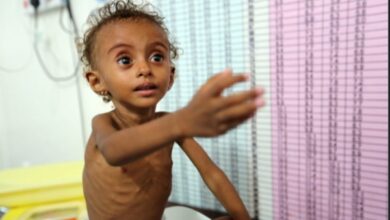 تقرير دولي يحذر من ارتفاع حالات سوء التغذية بين الأطفال في اليمن إلى مستوى "مقلق وخطير"