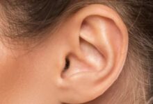 أسباب وأعراض التهاب قناة الأذن.. تعرف عليه