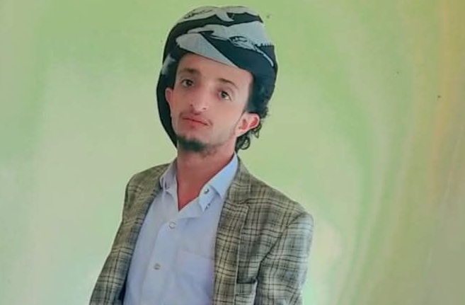إصابة شاب برصاص عصابة مسلحة في إب وسط تصاعد الفوضى الأمنية 1 إصابة شاب برصاص عصابة مسلحة في إب وسط تصاعد الفوضى الأمنية