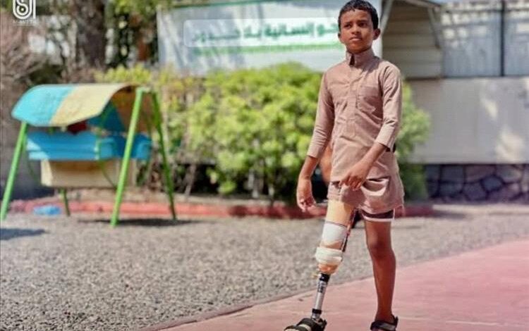 مركز الأطراف الصناعية بعدن يقدم خدماته الطبية والفنية لـ 595 مستفيداً