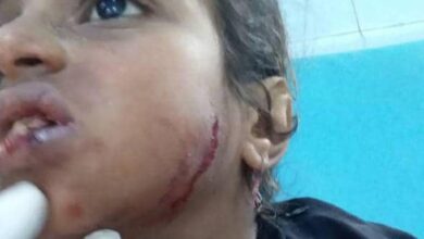 جرح طفلة في اعتداء حوثي مسلح جنوب الحديدة