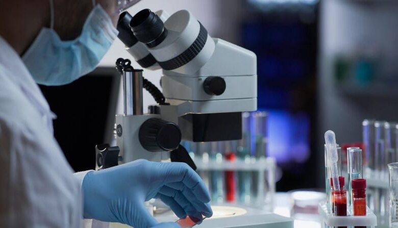 ابتكار جهاز لتحليل الدم دون أخذ عينة منه 1 ابتكار جهاز لتحليل الدم دون أخذ عينة منه