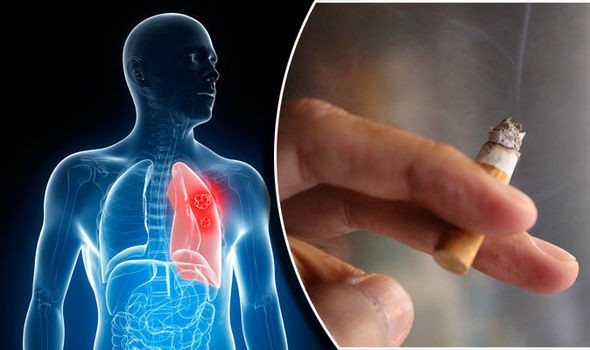 5 عادات أخطر على صحة الإنسان من التدخين