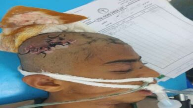 الحديدة.. العثور على مصاب مجهول بعد حادث مروري شرق المنصورية