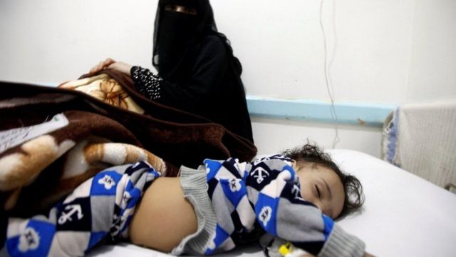 الصحة العالمية: انخفاض عدد حالات الإصابات بالكوليرا في اليمن 1 الصحة العالمية: انخفاض عدد حالات الإصابات بالكوليرا في اليمن