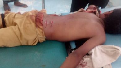 بعثة "اونمها" قلقها بعد إصابة خمسة أطفال بقصف حوثي في حيس
