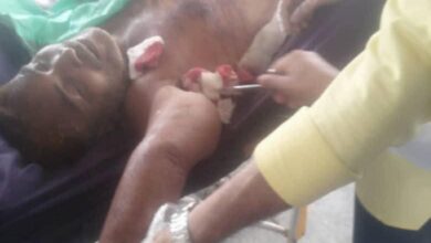 جرائم الحوثي في الحديدة.. قمع ممنهج ودماء تُسفك في وضح النهار