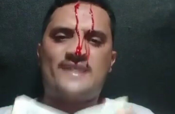 سجين من الحديدة يهدد بالانتحار بعد 8 سنوات ظلمًا في سجون الحوثي 1 سجين من الحديدة يهدد بالانتحار بعد 8 سنوات ظلمًا في سجون الحوثي
