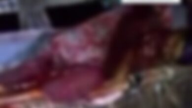 عصابة إجرامية تقطع لسان أمرأه شرق الحديدة