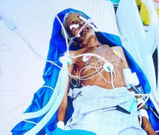 وفاة مسن بعد الاعتداء عليه في الجراحي بالحديدة بزعم الإفطار في رمضان 1 وفاة مسن بعد الاعتداء عليه في الجراحي بالحديدة بزعم الإفطار في رمضان