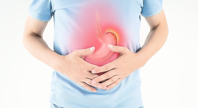 كيف تتجنب حرقة المعدة وارتجاع المريء خلال رمضان؟ 1 كيف تتجنب حرقة المعدة وارتجاع المريء خلال رمضان؟