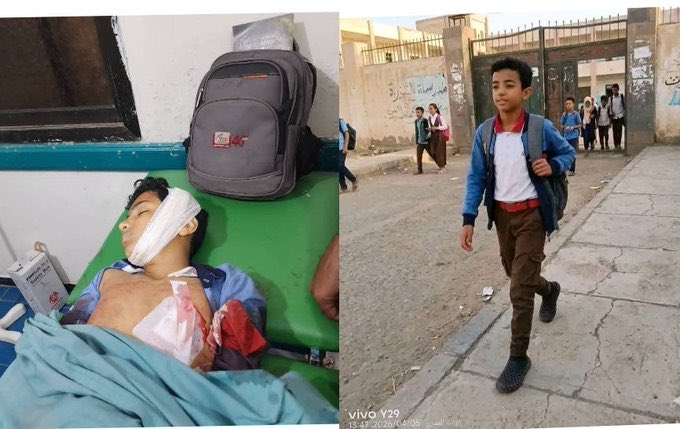 استشهاد طفل برصاص قناص حوثي في تعز 1 استشهاد طفل برصاص قناص حوثي في تعز